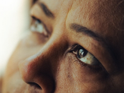 Blefaroplastia na Avenida Paulista | Cirurgia Pl�stica das P�lpebras em S�o Paulo